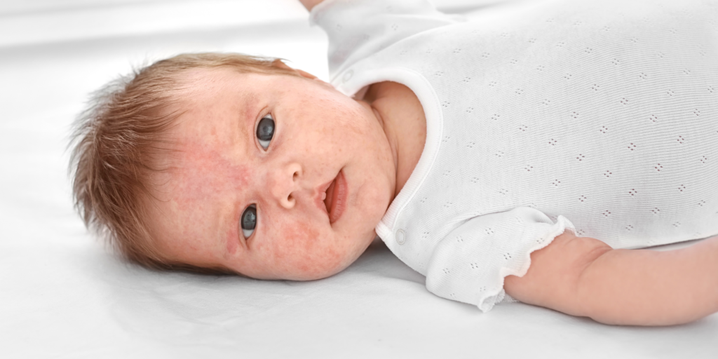 allergie enfant