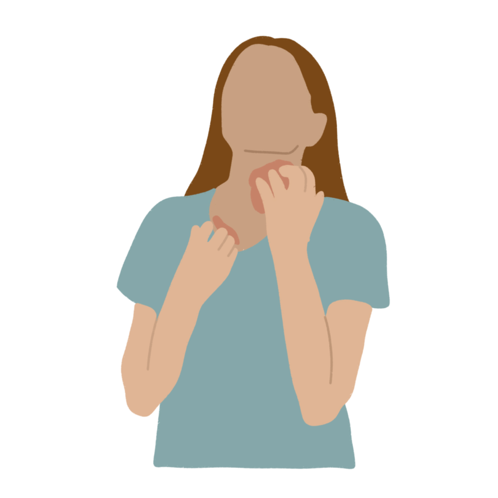 Eczema
