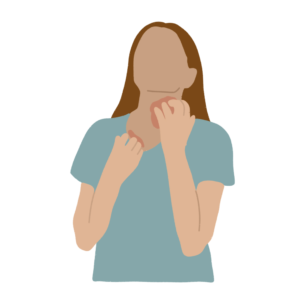Eczema